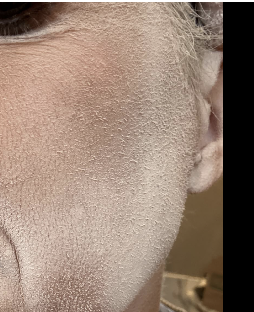 So satisfying!! Smooth skin ensues!